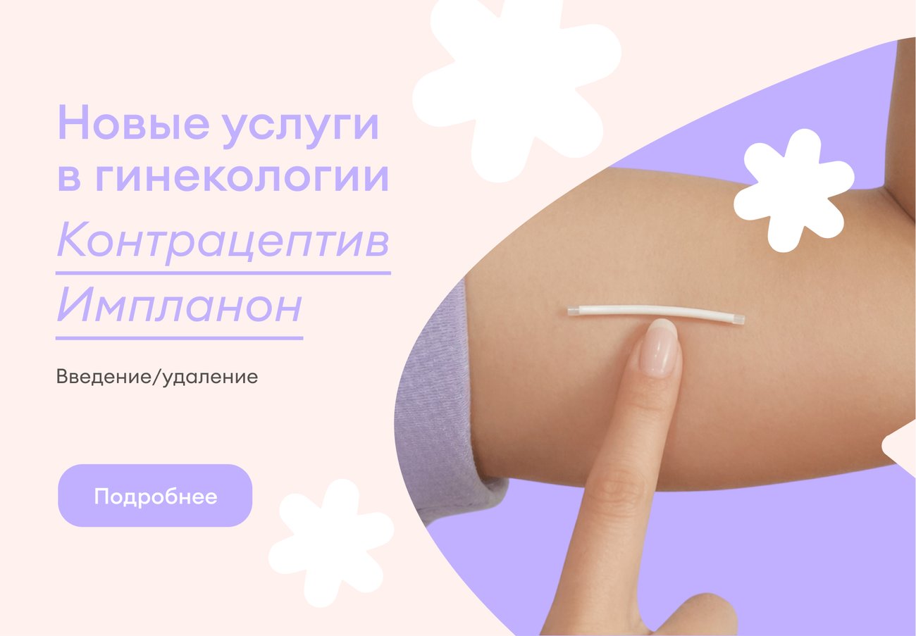 Живите без оглядки на календарь. Контрацепция длительного действия. Живите без оглядки на календарь. Контрацепция длительного действия.